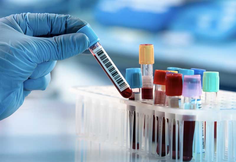 Precision   Diagnostics  


 
